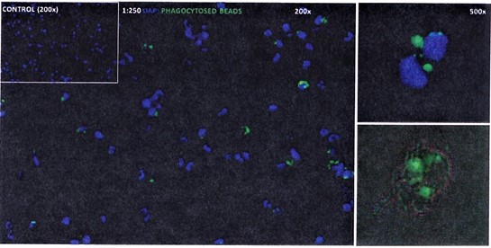 Kupffer Cells_Phagocytosed beads.jpg